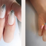 Tırnak Yeme Tedavisi