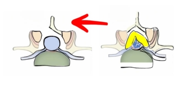 Dar Kanal Hakkında Bilinmesi Gereken 5 Madde