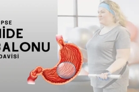 Yutulabilir Mide Balonu Fiyat