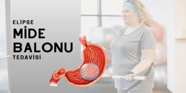 Yutulabilir Mide Balonu Fiyat