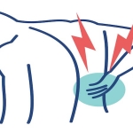 Karda Düşme Sonrası Omurga Kırığı: Kış Aylarında Gizli Tehlike