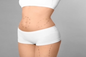 Yeni Yıla Daha Fit Bir Başlangıç: Karın Germede Op. Dr. Gökhan Semerci Uzmanlığı