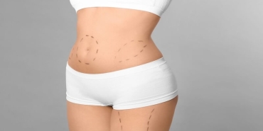 Yeni Yıla Daha Fit Bir Başlangıç: Karın Germede Op. Dr. Gökhan Semerci Uzmanlığı