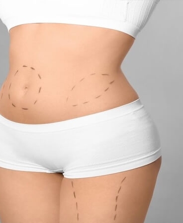 Yeni Yıla Daha Fit Bir Başlangıç: Karın Germede Op. Dr. Gökhan Semerci Uzmanlığı