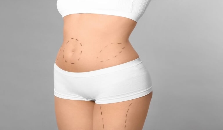 Yeni Yıla Daha Fit Bir Başlangıç: Karın Germede Op. Dr. Gökhan Semerci Uzmanlığı