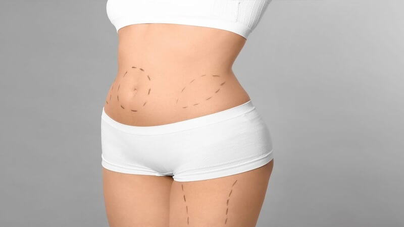 Yeni Yıla Daha Fit Bir Başlangıç: Karın Germede Op. Dr. Gökhan Semerci Uzmanlığı