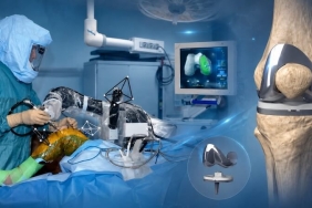 Robotik Kalça Protezi Nedir?